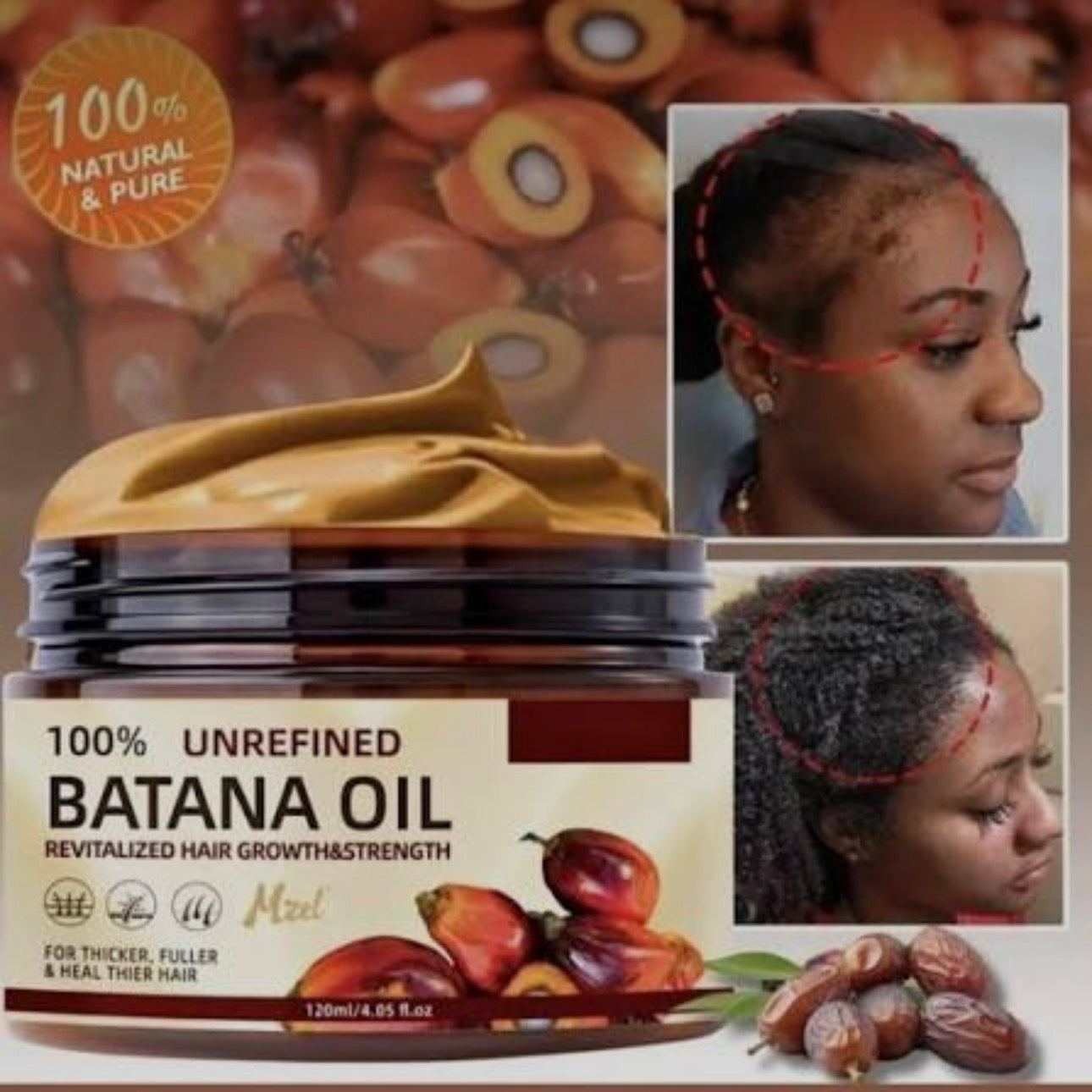 Huile de batana : contre la chute de cheveux et calvitie